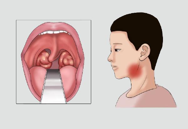 白领久坐易伤腰 护腰试试这些小办法